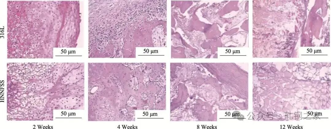 高氮无镍不锈钢研究进展及应用